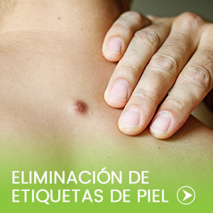 Eliminación de verrugas en Manatee Primary Care en Bradenton, Florida