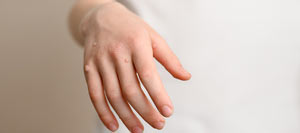 Cryotherapy for Warts and Skin Lesions Near Me in Bradenton, FL