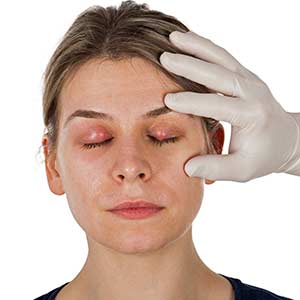 Incision and Drainage of Abscesses in Bradenton, FL