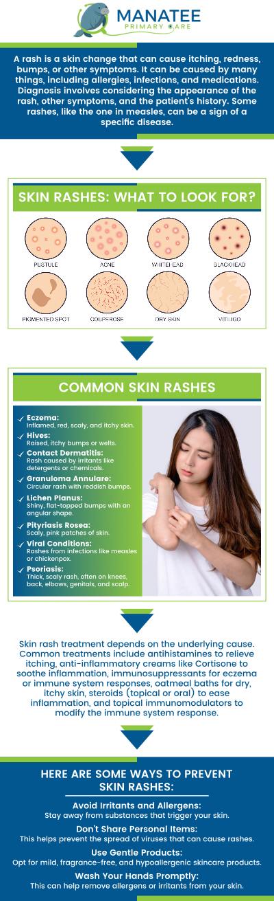 Common questions asked by patients: What are the common causes of skin rashes? How can you identify different types of skin rashes? When should you see a doctor for a skin rash? How can you prevent or manage skin rashes at home? For more information, contact us or request an appointment online. We are conveniently located at 6302 Manatee Ave W, Suite D, Bradenton, FL 34209. We serve patients from Bradenton FL, Parrish FL, Bayshore Gardens FL, Memphis FL, South Bradenton FL, Palmetto FL, and surrounding areas. Common questions asked by patients: What are the common causes of skin rashes? How can you identify different types of skin rashes? When should you see a doctor for a skin rash? How can you prevent or manage skin rashes at home? For more information, contact us or request an appointment online. We are conveniently located at 6302 Manatee Ave W, Suite D, Bradenton, FL 34209. We serve patients from Bradenton FL, Parrish FL, Bayshore Gardens FL, Memphis FL, South Bradenton FL, Palmetto FL, and surrounding areas.
