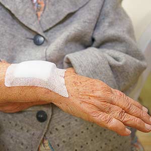 Minor Laceration Repairs in Bradenton, FL