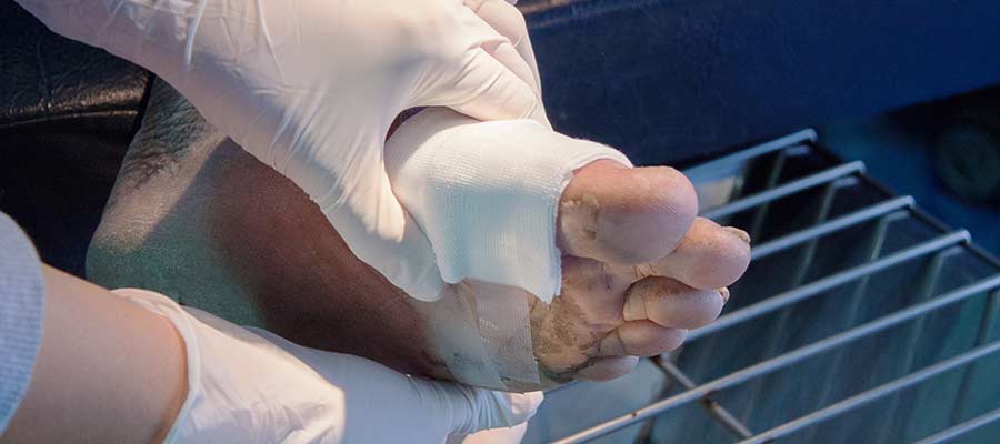 Pressure Ulcers (Bedsores) Treatment Clinic Near Me in Bradenton, FL