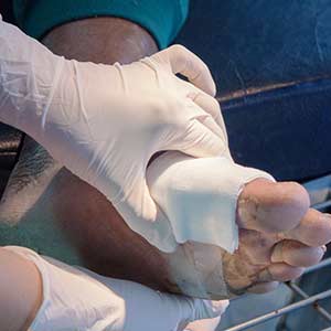 Pressure Ulcers Treatment in Bradenton, FL