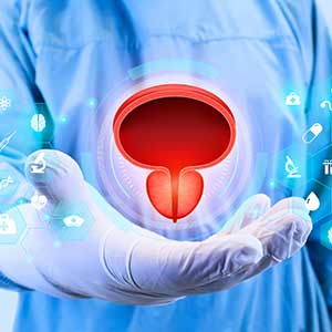 Prostate Screening in Bradenton, FL