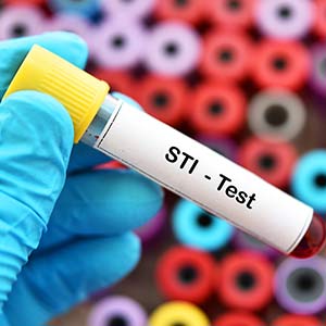 STI Testing in Bradenton, FL